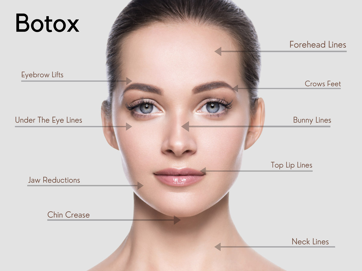 Botox Dysport Jeuveau Frown Lines Crow S Feet Treatment In