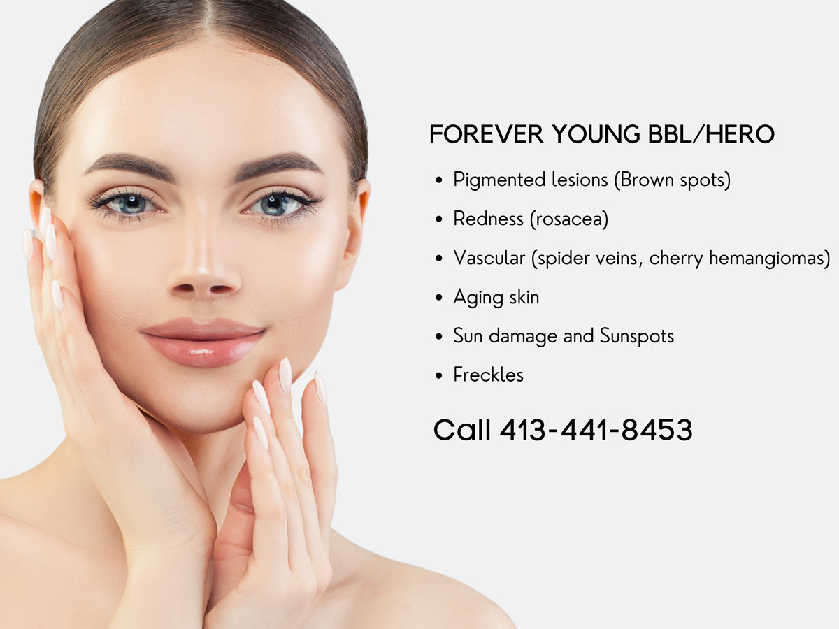 forever-young-bbl-hero-treatment-in-pittsfield-ma-silver-solutions-medspa