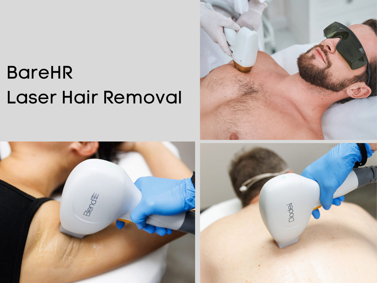 BareHR Laser Hair Removal for Men